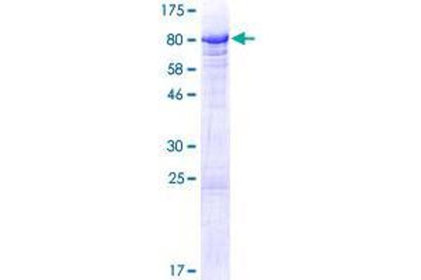 BANP Protein (AA 1-469) (GST tag)