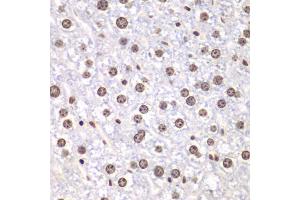 Immunohistochemistry of paraffin-embedded mouse liver using TOP1 antibody (ABIN6290286) at dilution of 1:100 (40x lens). (Topoisomerase I 抗体)