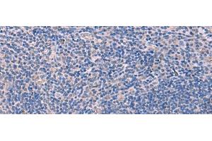 Immunohistochemistry of paraffin-embedded Human tonsil tissue using SCCPDH Polyclonal Antibody at dilution of 1:85(x200) (SCCPDH 抗体)