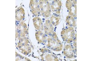 Immunohistochemistry of paraffin-embedded human gastric using BAG5 antibody at dilution of 1:100 (x40 lens). (BAG5 抗体)