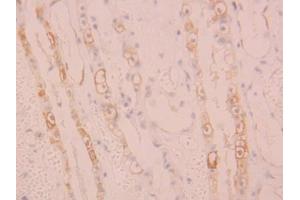 IHC-P analysis of Human Kidney Tissue, with DAB staining. (ALOX15 抗体  (AA 170-312))