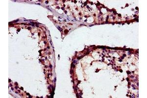 Immunohistochemistry of paraffin-embedded human testis tissue using ABIN7154107 at dilution of 1:100 (GSTM3 抗体  (AA 1-225))