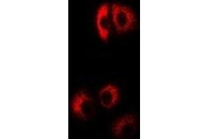 Immunofluorescent analysis of EIF4B staining in Hela cells. (EIF4B 抗体)