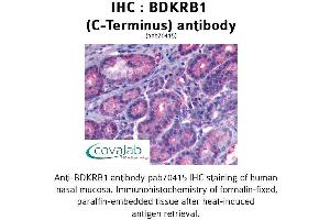 Image no. 1 for anti-Bradykinin Receptor B1 (BDKRB1) (C-Term) antibody (ABIN2852366) (BDKRB1 抗体  (C-Term))