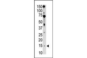 Image no. 1 for anti-BCL2-Interacting Killer (Apoptosis-Inducing) (BIK) (N-Term) antibody (ABIN356832) (BIK 抗体  (N-Term))