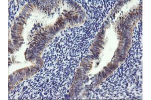 Image no. 5 for anti-Armadillo Repeat Containing 1 (ARMC1) antibody (ABIN1496727)
