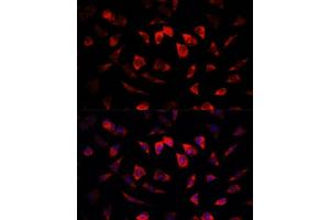 Immunofluorescence analysis of L929 cells using IGFBP4 antibody (ABIN6130488, ABIN6142255, ABIN6142256 and ABIN6219173) at dilution of 1:100. (IGFBP4 抗体  (AA 22-258))