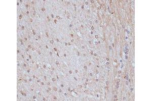 Immunohistochemistry (Paraffin-embedded Sections) (IHC (p)) image for anti-SNW Domain Containing 1 (SNW1) antibody (ABIN7257970)