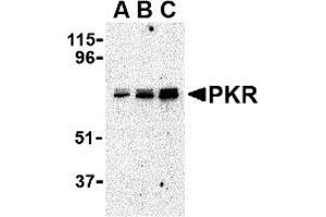 Western Blotting (WB) image for anti-Eukaryotic Translation Initiation Factor 2-alpha Kinase 2 (EIF2AK2) (C-Term) antibody (ABIN1030589) (EIF2AK2 抗体  (C-Term))