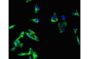 Immunofluorescence (IF) image for anti-Regulatory Associated Protein of mTOR, Complex 1 (RPTOR) (AA 13-128) antibody (ABIN7167652)