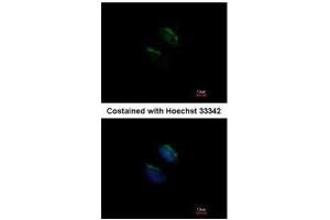 ICC/IF Image Immunofluorescence analysis of methanol-fixed HeLa, using GnT-III, antibody at 1:200 dilution. (MGAT3 抗体)