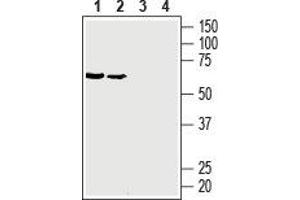Western Blotting (WB) image for anti-Solute Carrier Family 2 (Facilitated Glucose Transporter), Member 3 (SLC2A3) (AA 39-52), (Extracellular) antibody (ABIN7043696)