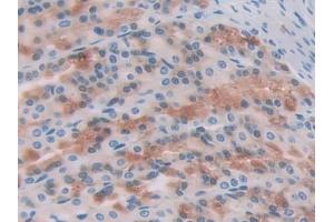 DAB staining on IHC-P; Samples: Rat Stomach Tissue (CCL17 抗体  (AA 27-93))