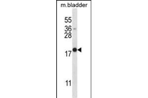 MYOG Antibody (N-term) (ABIN657743 and ABIN2846727) western blot analysis in mouse bladder tissue lysates (35 μg/lane). (Myogenin 抗体  (N-Term))