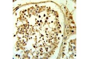 Fascin-3 antibody IHC analysis in formalin fixed and paraffin embedded human testis tissue. (Fascin 3 抗体  (AA 1-30))