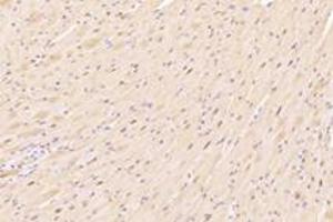 Immunohistochemistry analysis of paraffin-embedded mouse heart using,ZFP90 (ABIN7076275) at dilution of 1: 4200 (ZNF90 抗体)