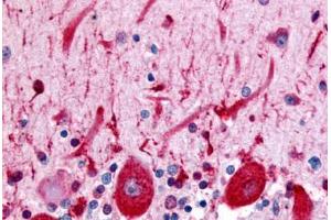 Anti-CELSR3 antibody  ABIN1048433 IHC staining of human brain, Purkinje neurons. (CELSR3 抗体  (N-Term))