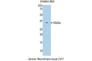 Western Blotting (WB) image for anti-Gap Junction Protein, beta 3, 31kDa (GJB3) (AA 213-270) antibody (ABIN1174652) (Connexin 31 抗体  (AA 213-270))