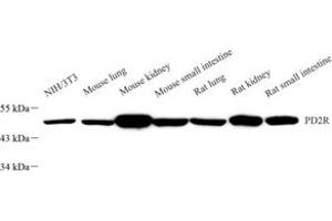 Western blot analysis of PD2R (ABIN7075206) at dilution of 1: 2000 (PTGDR 抗体)