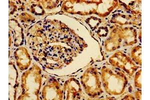 Immunohistochemistry of paraffin-embedded human kidney tissue using ABIN7175412 at dilution of 1:100 (AVPR2 抗体  (AA 221-271))