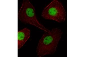 Fluorescent image of U251 cell stained with PGR/PR Antibody . (PGLYRP1 抗体  (C-Term))