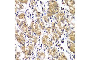 Immunohistochemistry of paraffin-embedded human gastric using DGKE antibody at dilution of 1:100 (40x lens). (DGKE 抗体)