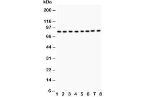 Western blot testing of BRAF antibody and Lane 1:  rat testis tissue;  2: rat brain tissue;  3: mouse testis tissue;  4: mouse brain tissue;  and human samples 5: HeLa;  6: Jurkat;  7: MCF-7;  8: K562 (BRAF 抗体  (AA 38-230))