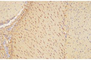 Immunohistochemistry of paraffin-embedded Mouse brain using PLAUR Ployclonal Antibody at dilution of 1:200. (PLAUR 抗体)