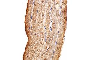 Paraformaldehyde-fixed, paraffin embedded Human skeletal muscle tissue, Antigen retrieval by boiling in sodium citrate buffer (pH6. (MAP4K3 抗体)