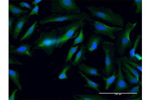 Immunofluorescence of purified MaxPab antibody to ANKMY1 on HeLa cell. (ANKMY1 抗体  (AA 1-720))