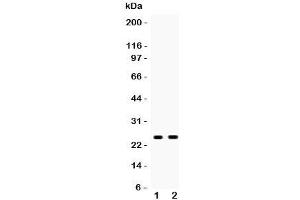 Western blot testing of PSCA antibody and Lane 1:  rat stomach;  2: mouse stomach;  Predicted size: 13KD;  Observed glycosylated size: up to 29KD (PSCA 抗体  (AA 21-95))