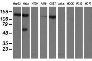 Western blot analysis of extracts (35 µg) from 9 different cell lines by using anti-L1CAM monoclonal antibody. (L1CAM 抗体)