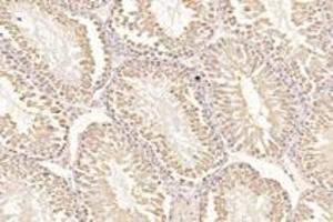 Immunohistochemistry analysis of paraffin-embedded mouse testis using,PSKH1 (ABIN7075291) at dilution of 1: 2800 (PSKH1 抗体)