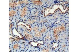 IHC-P analysis of kidney tissue, with DAB staining. (FAM132A 抗体  (AA 92-241))
