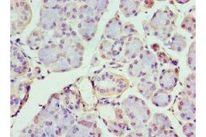 Immunohistochemistry of paraffin-embedded human pancreatic tissue using ABIN7156650 at dilution of 1:100 (IFIH1 抗体  (AA 1-205))