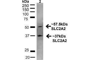 Western blot analysis of Rat Liver showing detection of ~57. (SLC2A2 抗体  (C-Term) (PE))