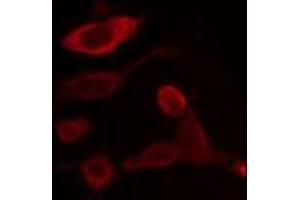 ABIN6266956 staining HeLa cells by IF/ICC. (CYP2U1 抗体  (Internal Region))