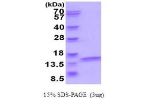 SDS-PAGE (SDS) image for ATPase, H+ Transporting, Lysosomal 14kDa, V1 Subunit F (ATP6V1F) (AA 1-119) protein (His tag) (ABIN5854054) (ATP6V1F Protein (AA 1-119) (His tag))