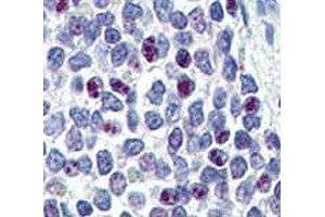 Immunohistochemistry (IHC) image for anti-Kruppel-Like Factor 4 (Gut) (KLF4) (AA 69-101) antibody (ABIN3031572)