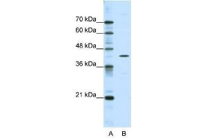Western Blot showing DOK2 antibody used at a concentration of 1-2 ug/ml to detect its target protein. (DOK2 抗体  (C-Term))