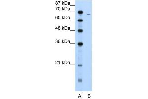 Fibrinogen Alpha antibody used at 5 ug/ml to detect target protein.