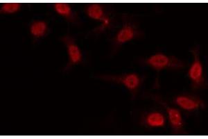 Immunofluorescence (fixed cells) (IF/ICC) image for anti-General Transcription Factor IIH, Polypeptide 2, 44kDa (GTF2H2) (N-Term) antibody (ABIN6265526)
