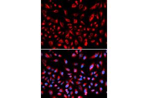 Immunofluorescence analysis of U2OS cells using CLDN11 antibody (ABIN5971415). (Claudin 11 抗体)