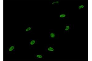 Immunofluorescence of monoclonal antibody to SNRPA on HeLa cell. (SNRPA1 抗体  (AA 1-282))