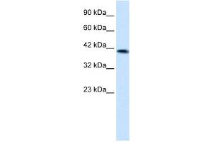 WB Suggested Anti-ZNF670 Antibody Titration:  1. (ZNF670 抗体  (N-Term))