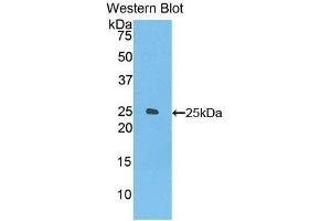 Detection of Recombinant FOLR4, Mouse using Polyclonal Antibody to Folate Receptor 4 (FOLR4) (Folate Receptor 4 抗体  (AA 56-234))