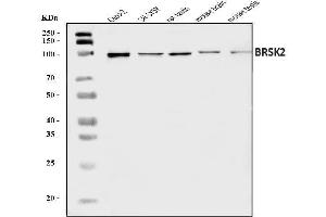 Western blot analysis of BRSK2 using anti-BRSK2 antibody (ABIN7600926).