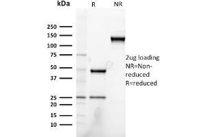 SDS-PAGE Analysis Purified Heregulin-1 Mouse Monoclonal Antibody (NRG1/2752). (Neuregulin 1 抗体  (AA 21-242))