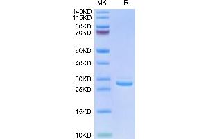 Human LILRB1 Domain1&2 on Tris-Bis PAGE under reduced conditions. (LILRB1 Protein (AA 24-221) (His tag))