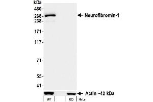 Western Blotting (WB) image for anti-Neurofibromin 1 (NF1) (C-Term) antibody (ABIN7795776) (Recombinant Neurofibromin 1 抗体  (C-Term))